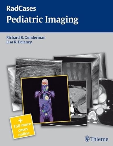 Radcases Pediatric Imaging: + 150 more cases online. Vorw.: Lorenz, Jonathan (Radcases Plus Q&A)